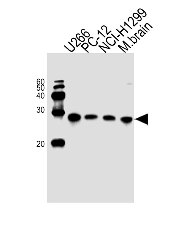 WB - UCHL1 Antibody (C-term) AW5142-U100